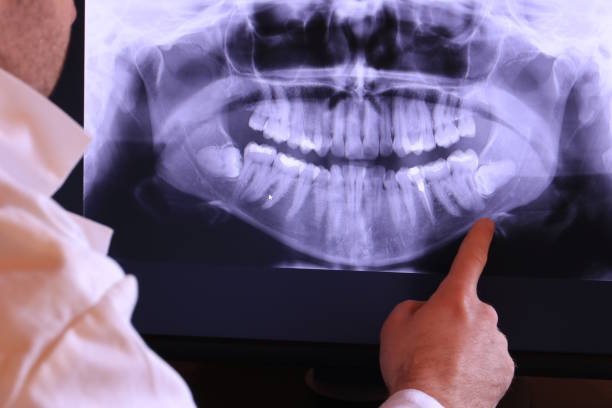Best Pediatric Emergency Dentist in Barrington, IL